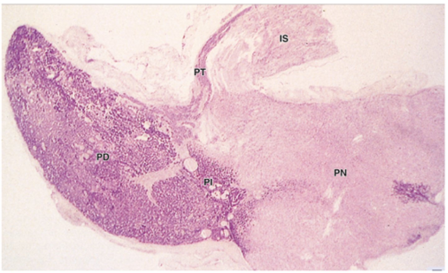 <p>What is the main cell type in the pars tuberalis?</p>