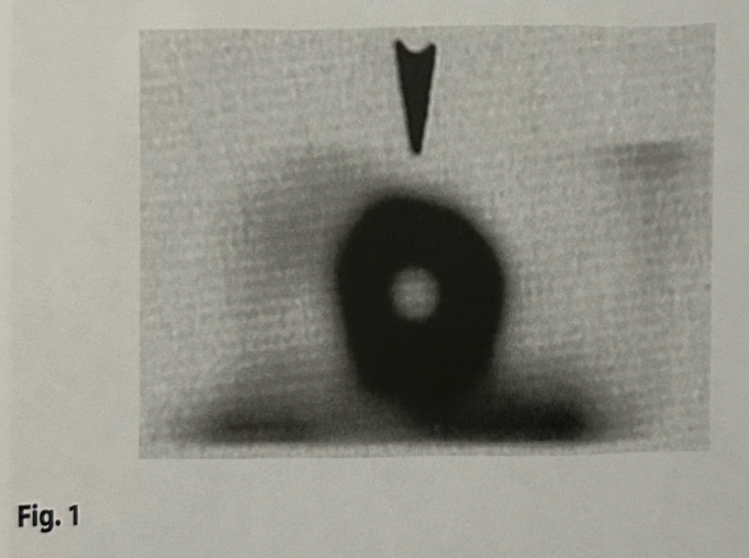 <p>The wall of the heart indicated by the arrow on Fig. 1 is the: </p>