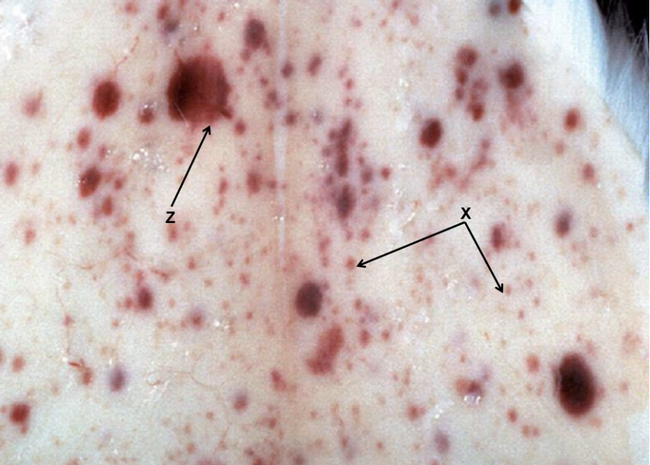 Which word best describes the lesion "Z" below?