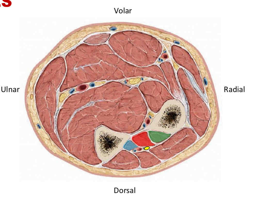 <p>Supinator*, Abductor Pollicis Longus (APL), Extensor Pollicis Brevis (EPB), Extensor Pollicis Longus (EPL), Extensor Indicis (EI).</p><p>On Cross Section: Abductor Pollicis Longus (APL), Extensor Pollicis Brevis (EPB), Extensor Pollicis Longus (EPL)</p>