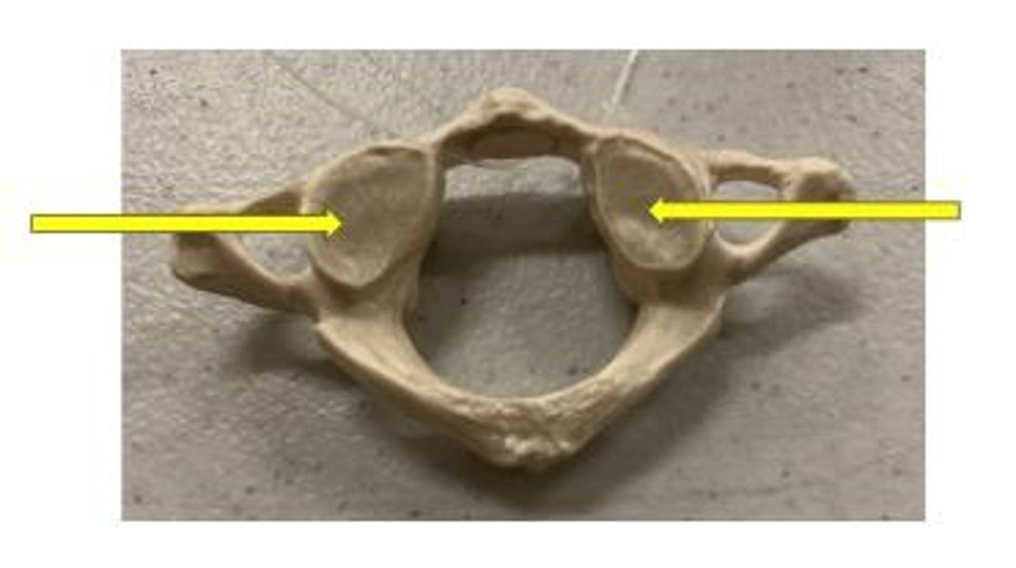 <p>articulates with the superior articular facet of C2 axis</p>