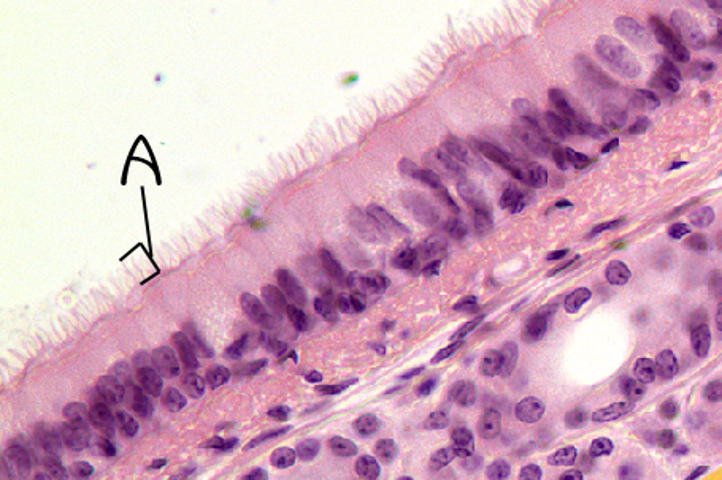 <p>A</p>