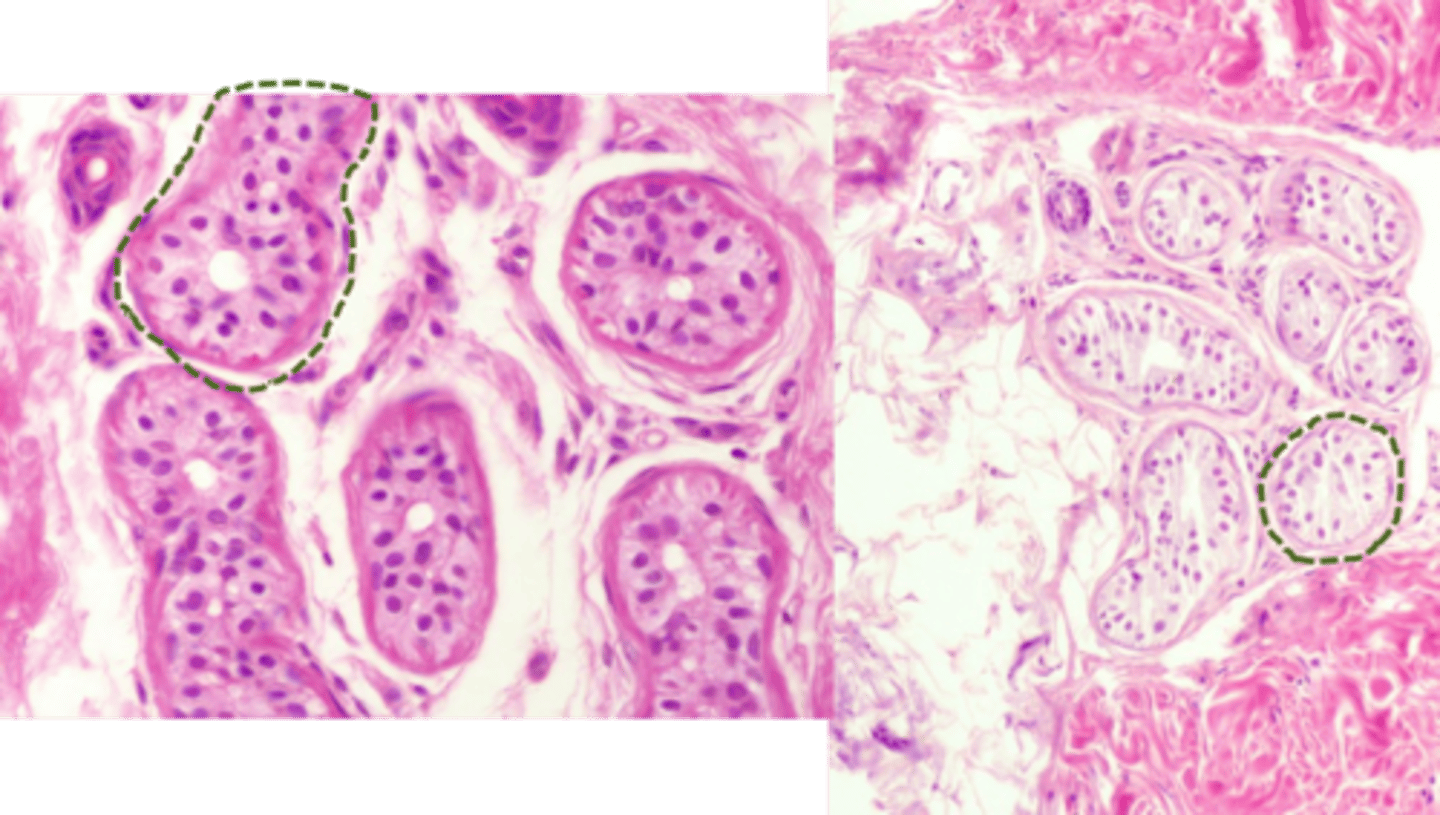 <p>Eccrine</p>