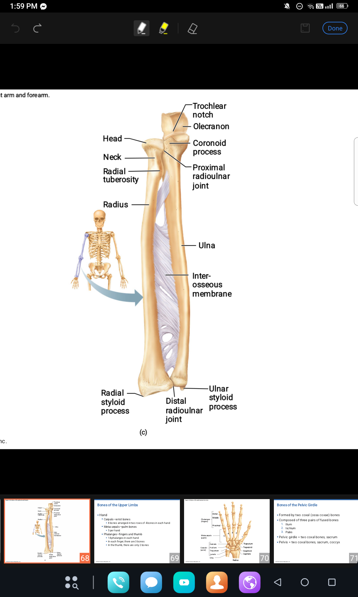 <p>ULNAR STYLOID PROCESS,  RADIAL STYLOID PROCESS </p>