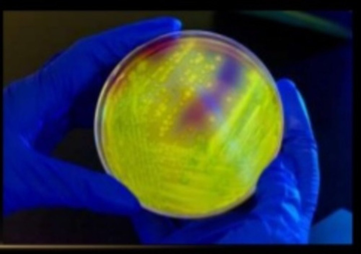 <p>Selective and differential for Clostridium difficile.</p>