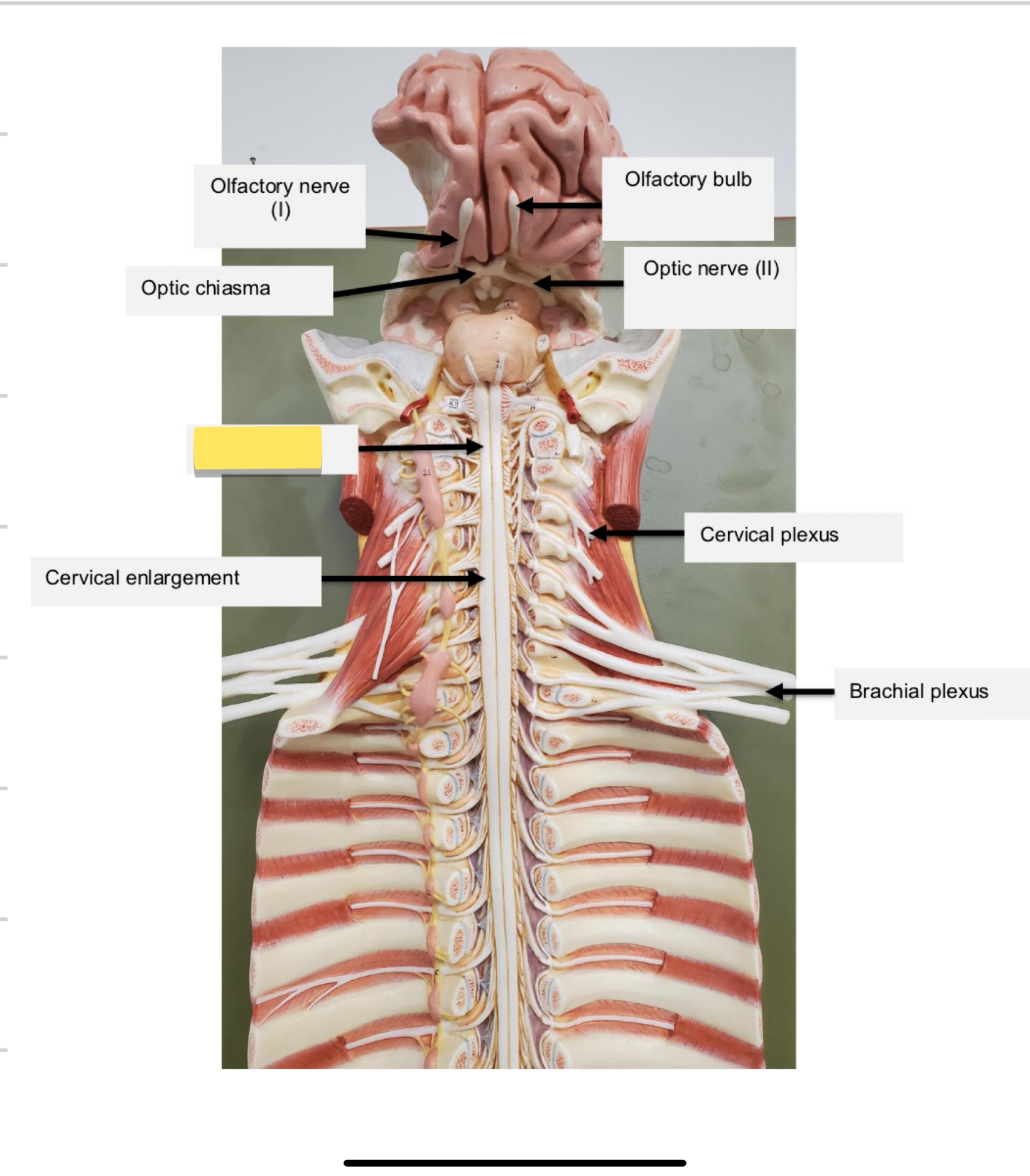 <p>Name this part</p>