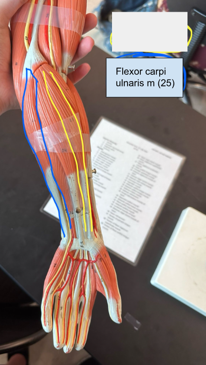 <p>Flexor carpi ulnaris muscle. This muscle stabilizes the wrist during finger extension.</p>