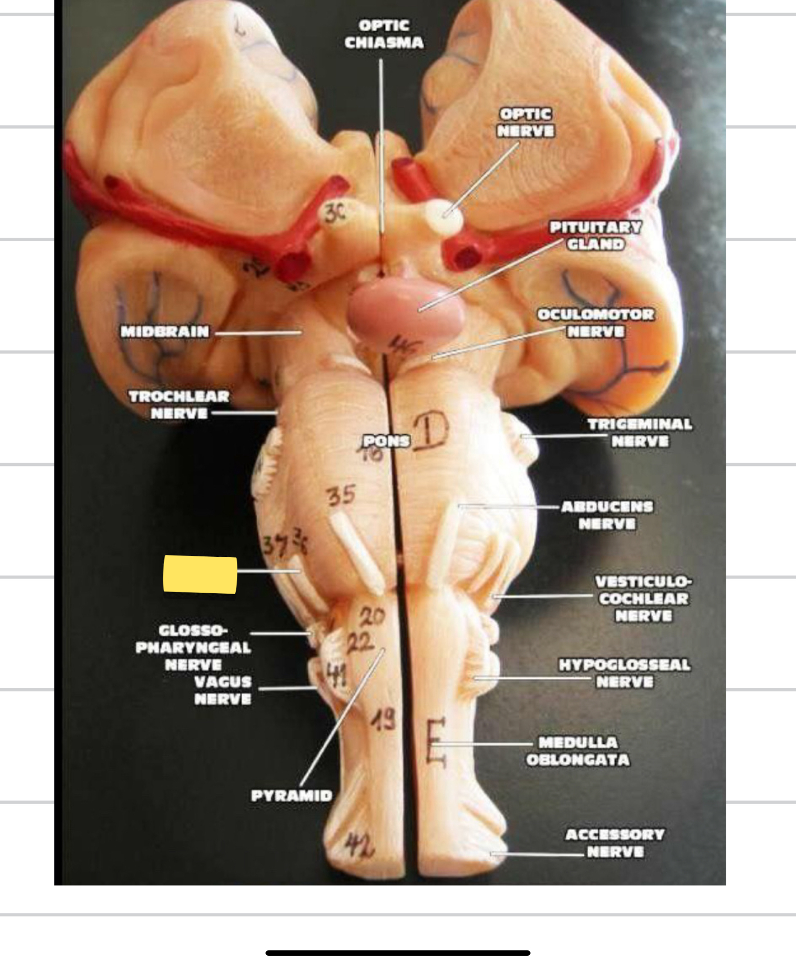 <p>Name this cranial nerve&nbsp;</p>