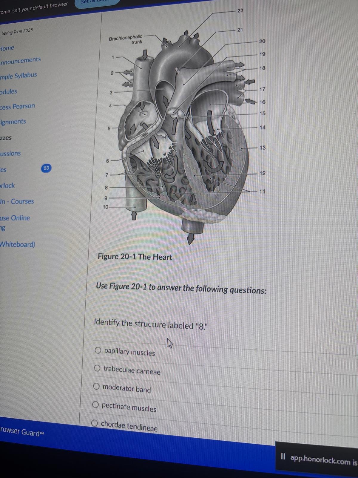 <p><span>Identify the structure labeled "8."</span></p><p><span>papillary muscles</span></p><p>trabeculae carneae</p><p>moderator band</p><p>pectinate muscles</p><p>chordae tendineae</p>