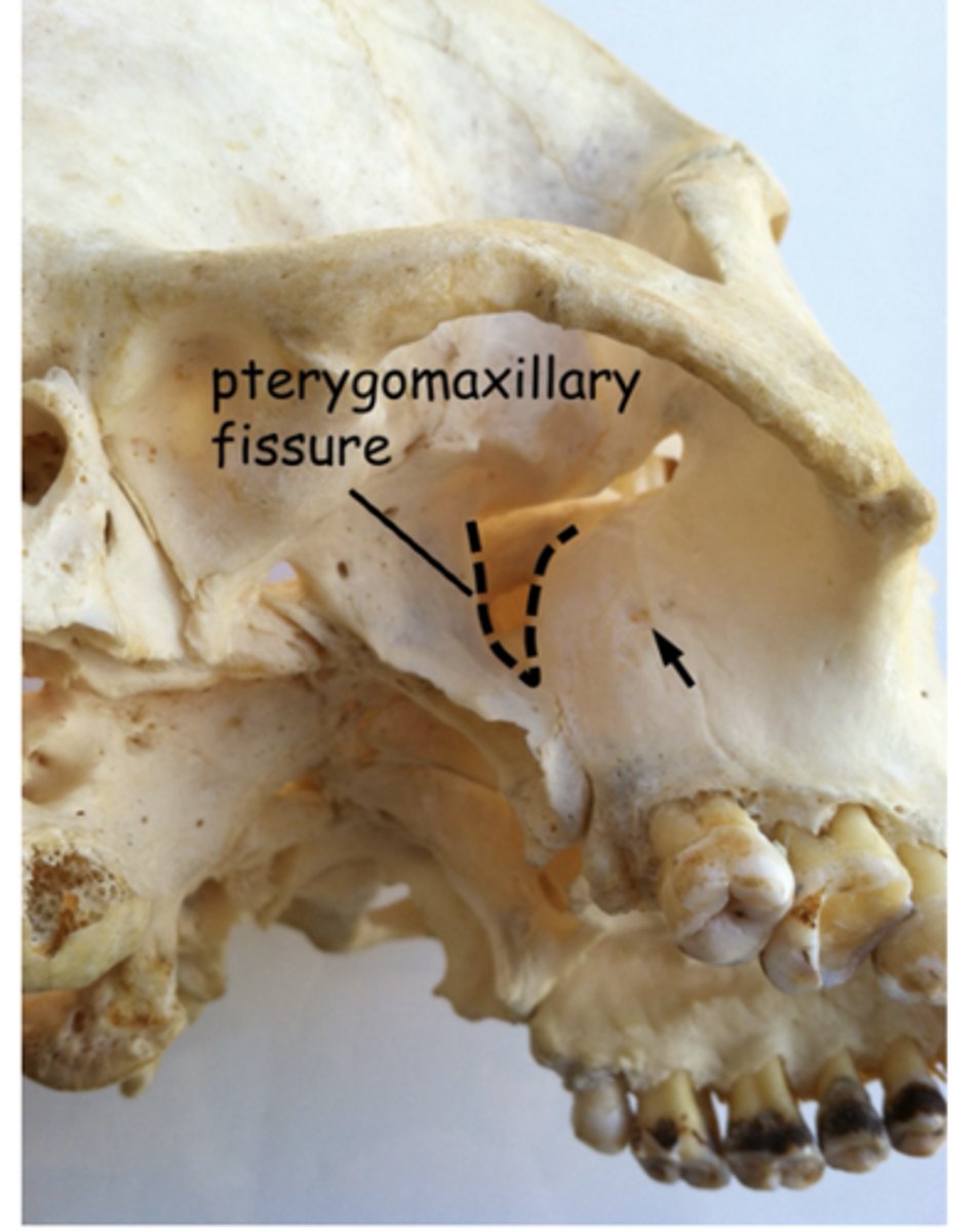 <p>Identify the structure at the arrow</p>