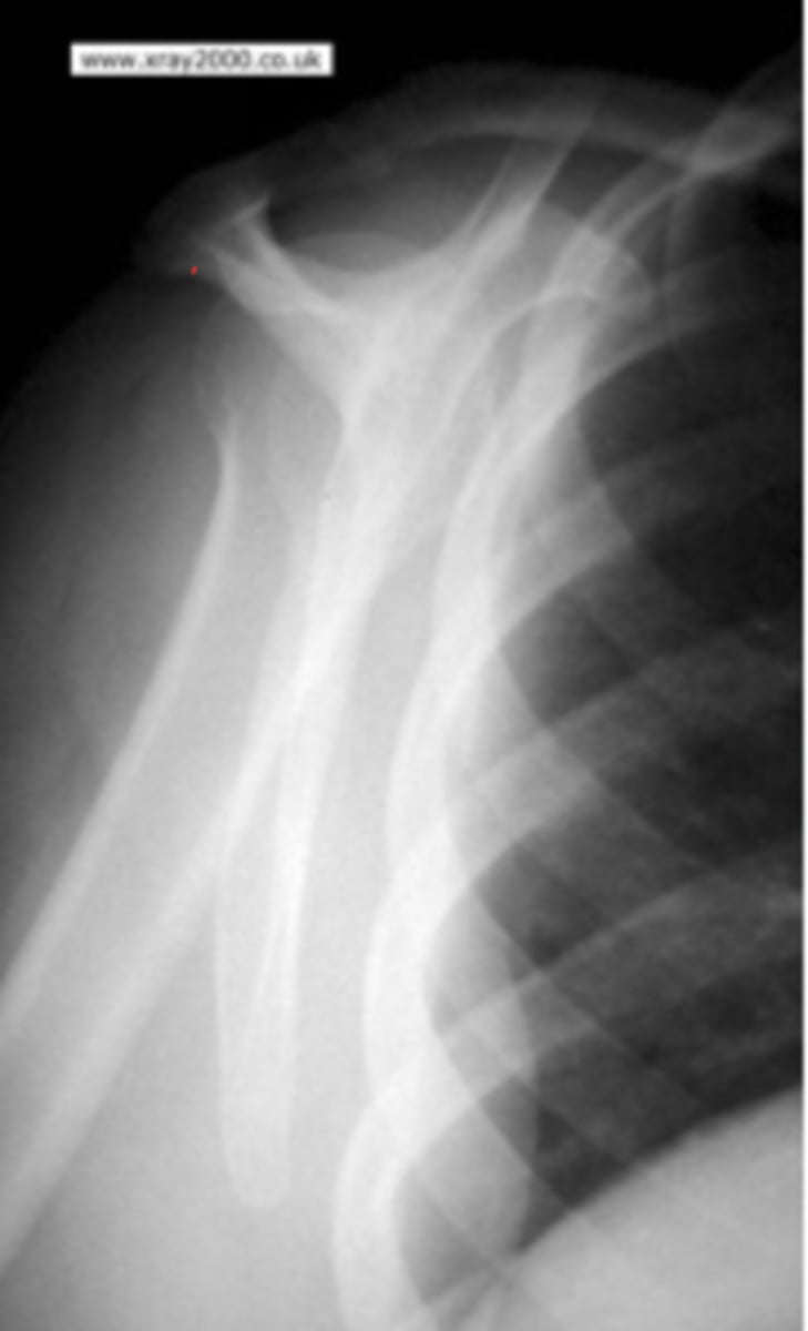 <p>What view is this?</p>