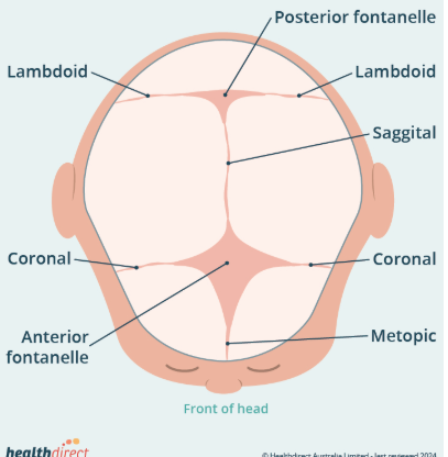 <p>Condition where the bones of a baby’s skull fuse together too early, before the brain is fully developed.</p>