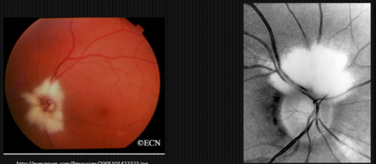 <p>myelinated nerve fibers</p>