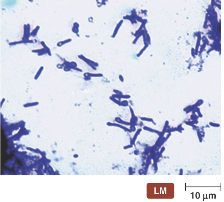 <ul><li><p>Release a <strong>potent neurotoxin (tetanospasmin)</strong> when they die.</p></li><li><p>Morphology</p><ul><li><p>Terminal endospore “Lollipop” appearance</p></li></ul></li><li><p>Symptoms</p><ul><li><p>Initial symptoms</p><ul><li><p>Tightening of jaw and neck muscles, called “lockjaw”</p></li><li><p>Sweating, drooling, grouchiness, back spasm</p></li></ul></li><li><p>Later symptoms</p><ul><li><p>Affect involuntary muscle</p></li><li><p>Irregular heartbeating, blood pressure fluctuation, and extensive sweating</p></li><li><p>Prevention involves destroying endospores in contaminated food through proper canning techniques</p></li></ul></li></ul></li></ul><p></p>