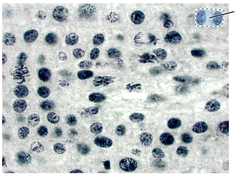 <p>What stage of mitosis is shown by the highlighted cells?</p><p>(Longitudinal section of an onion root tip).</p>