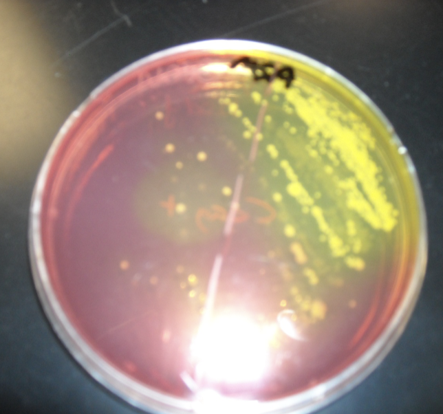 <p>What type of plate and what is the yellow?</p>