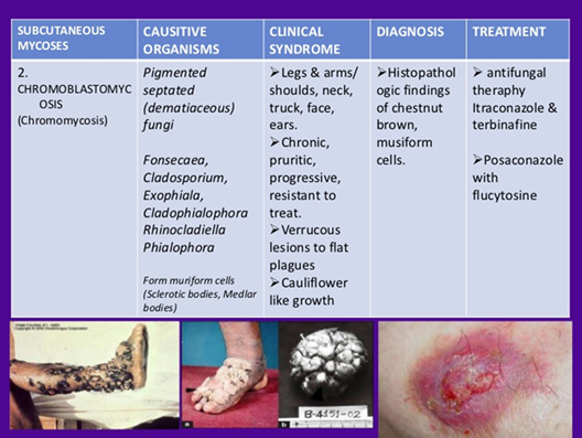 <ul><li><p class=""><strong>Histopathology</strong> showing <strong>Medlar bodies</strong></p></li><li><p class="">Confirmation by <strong>culture</strong></p></li></ul><p></p>