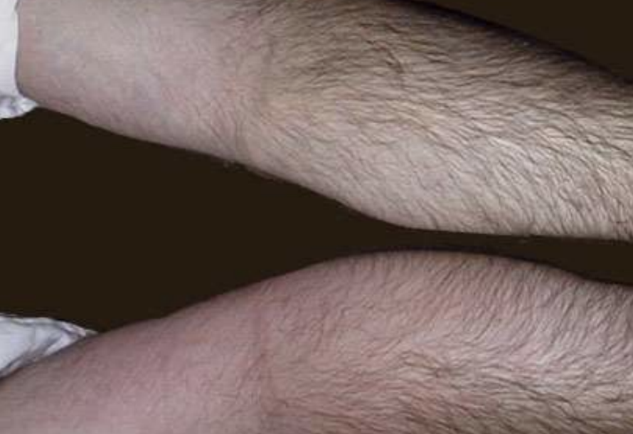 <p>Tumor </p>
