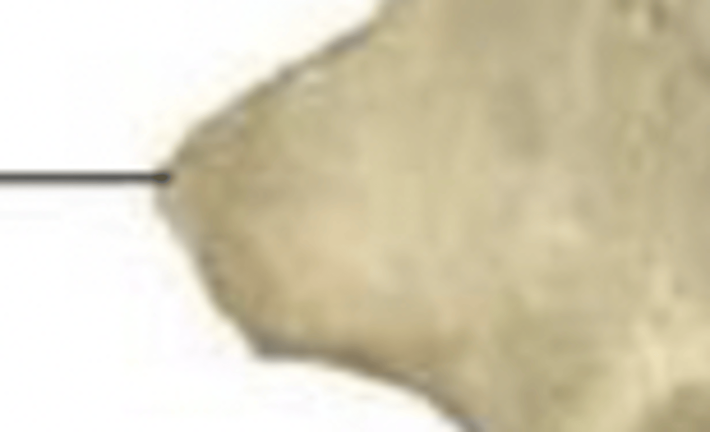 <p>ischial spine</p>