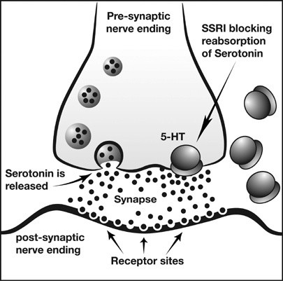 <p>SSRIs (Serotonin Selective Reuptake Inhibitors) are a medication class (namely for Prozac and Zoloft) designed to treat depression and other disorders. They selectively inhibit the reabsorption of serotonin (because too much absorption will leave scarce serotonin to be processed).</p><p><strong>Note: reabsorption DOES occur, but SSRIs help selectively inhibit it so that TOO MUCH reabsorption doesn’t happen.</strong></p><p><em>It’s like an inhibitor that stops you from wanting to unsend a text message; it lets you send it without retracting it.</em></p>