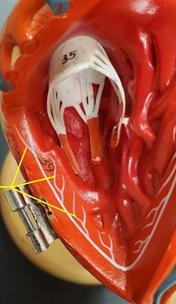 <p>ID the Cardiac Conduction Structure (#39)</p>