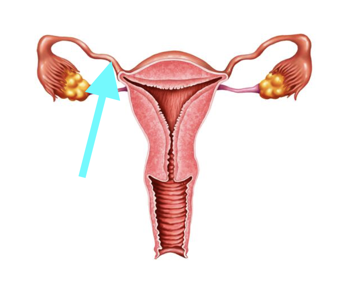 <p>What structure is shown?</p>