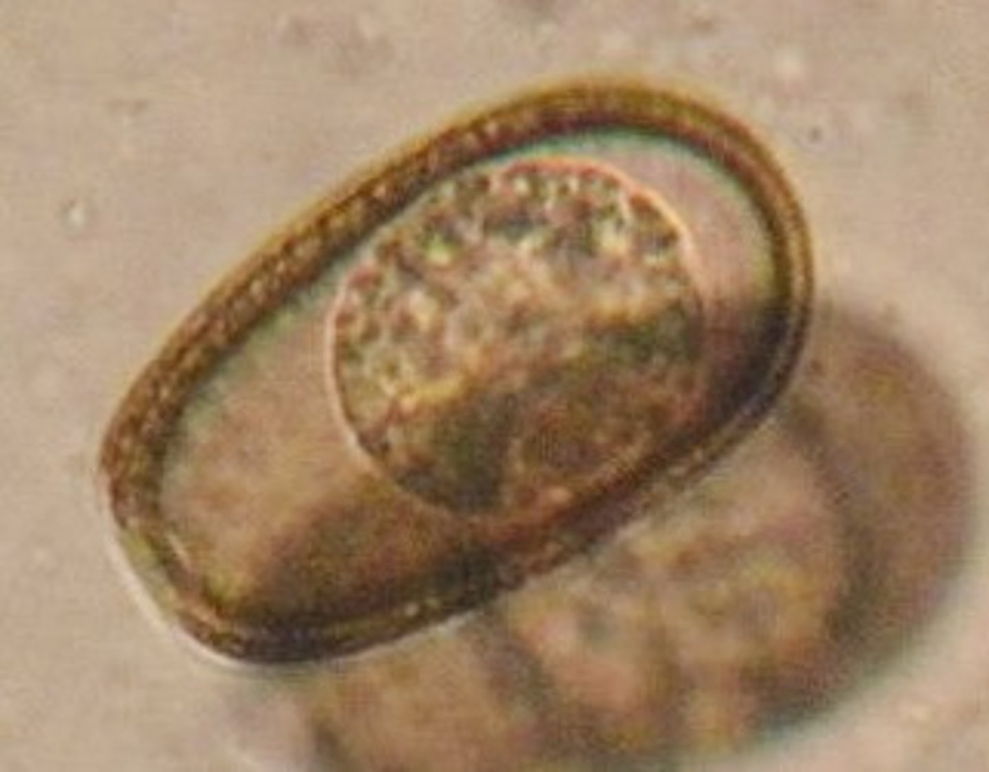 <p>When "eggs" that look like these are found on the fecal flotation of a dog, what is your best guess of their identity. They measure ~40x30, have a rough or texture-like surface, and a thin operculum-like structure on one end.</p>