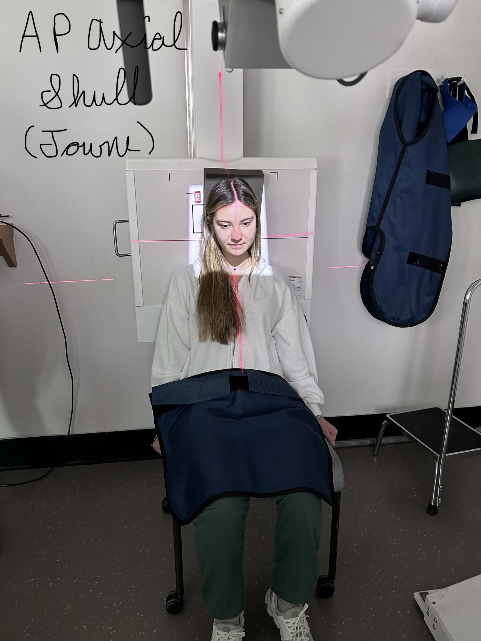 AP Axial Skull (Towne)