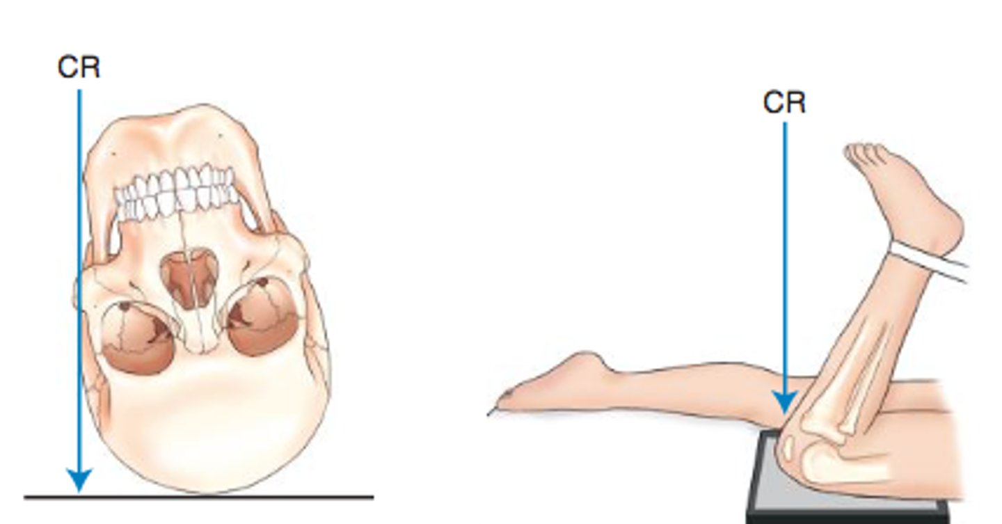 <p>The CR skims the body part that is being xrayed</p>