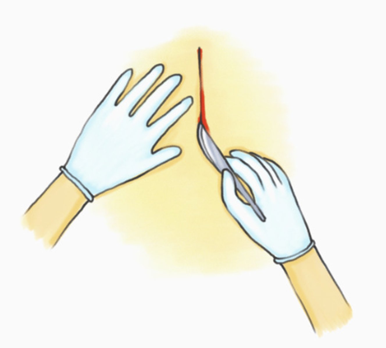 <p>the process of cutting apart or separating tissue</p>