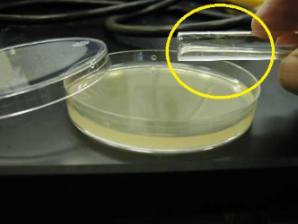 <p>Identify the culture medium (encircled) used in one of the methods in isolating pure culture of microorganisms.</p>