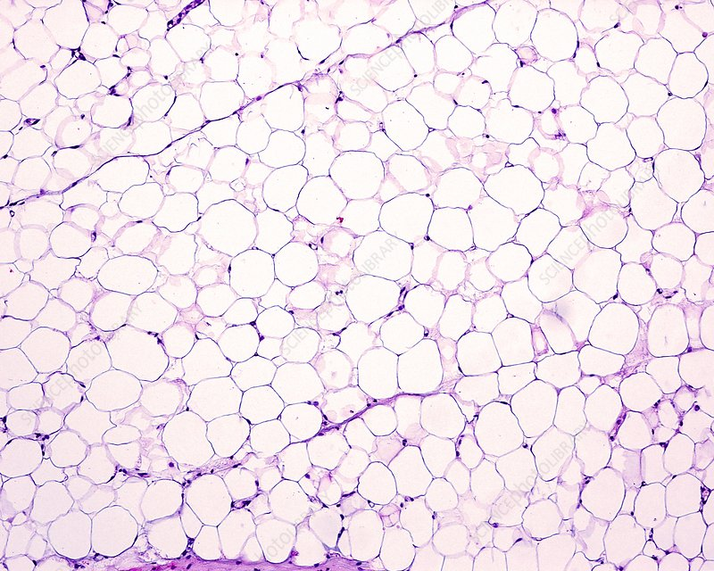 <p>What tissue is this? Is there any issue with this image? What stain was mentioned in class?</p>