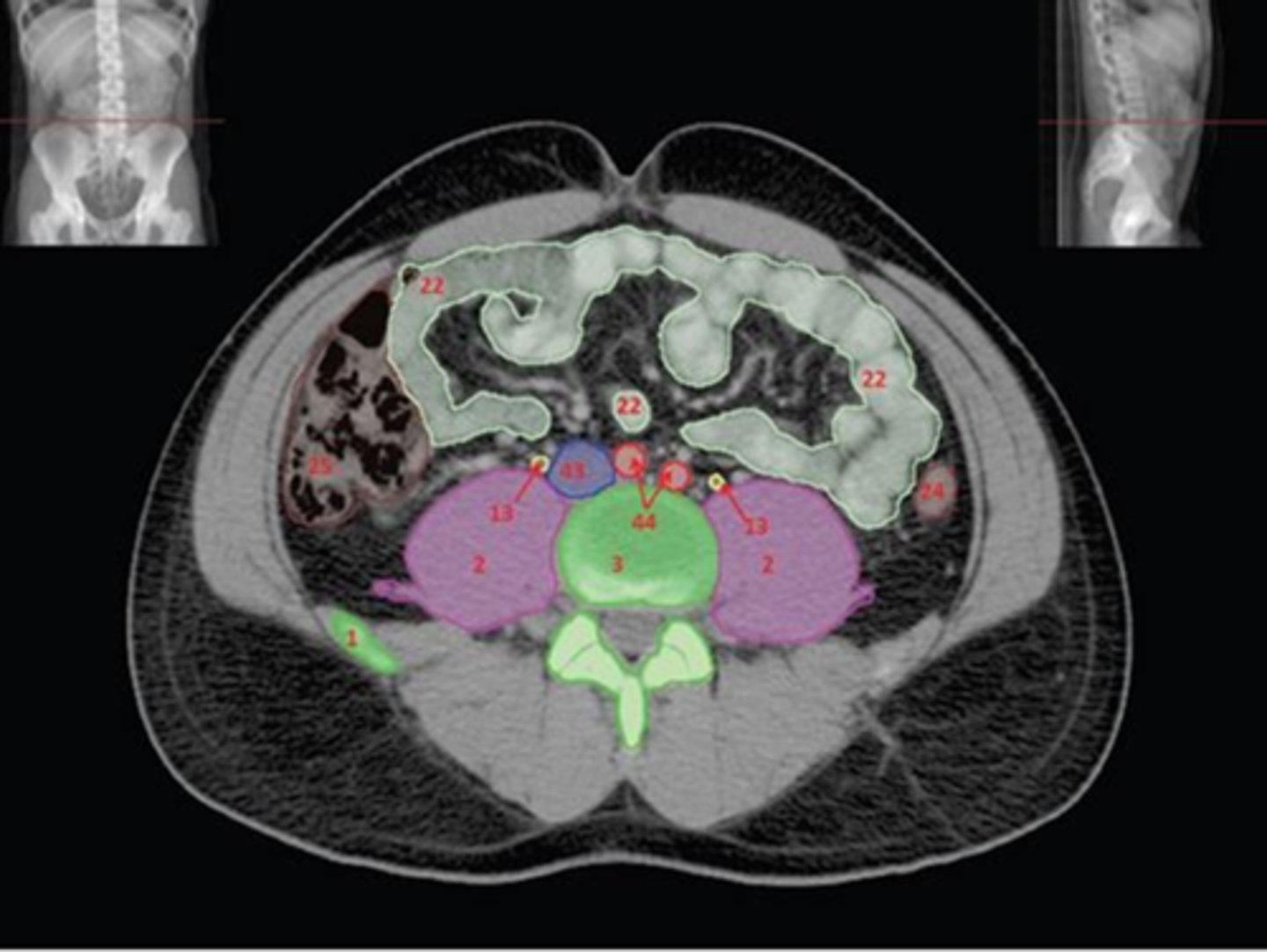 <p>What type of vertebrae is this and how can you tell</p>
