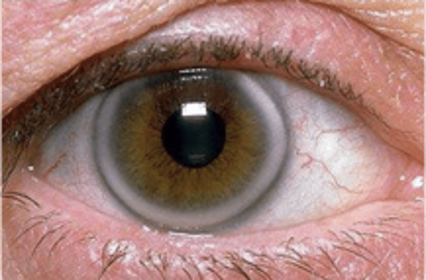 <p>name the abnormality</p>