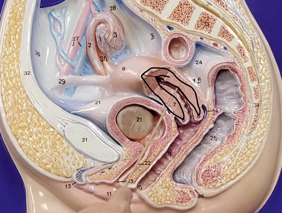 <p>thick muscular layer of the uterus </p>