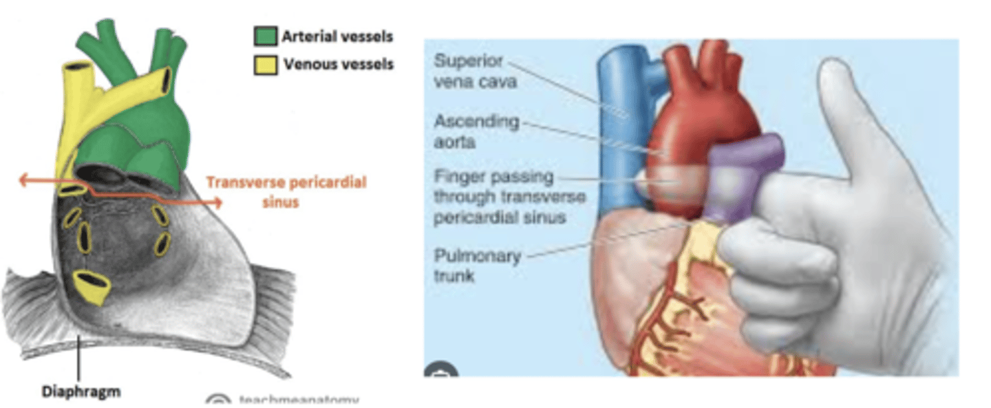 <p>Surgeons use it during cardiac procedures.</p><p>By passing a finger or clamp through the sinus they can isolate these arteries and control blood flow to the heart during surgeries like coronary artery bypass grafting (CABG).</p>