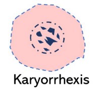 <p>Karyorrhexis </p>