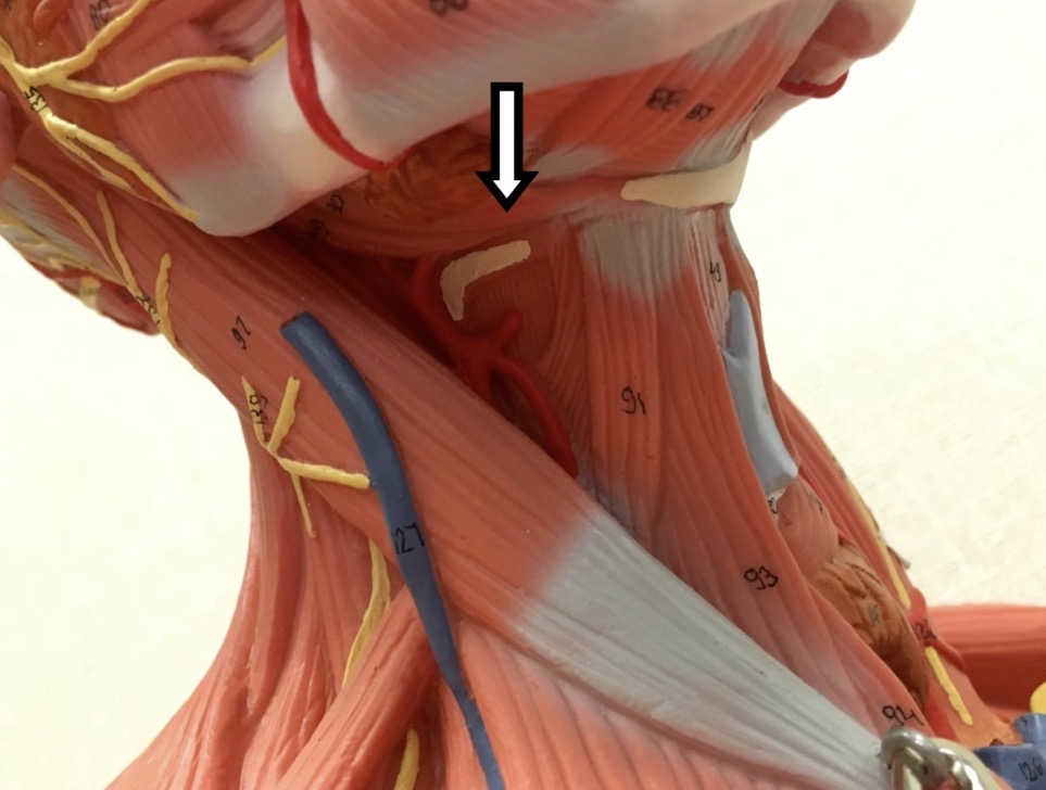 <p><span>Name the muscle labeled with the white arrow below:</span></p>