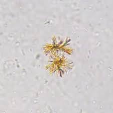 <p>Form in acidic pH</p><p>Form from conjugated _________</p><p>Associated with hepatic disorders and liver disease</p>