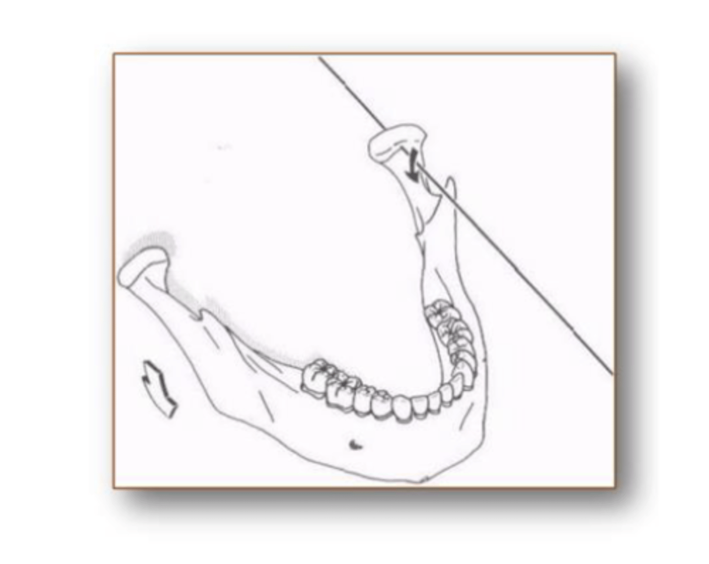 <p>Sker tillsammans med andra ledrörelser som ex enkelsidig avbitning</p>