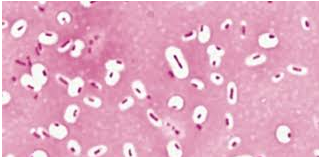 <p><span style="background-color: transparent;"><span>are a gelatinous cover DOES NOT ACCEPT MOST DYES&nbsp;</span></span></p>