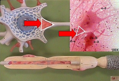 <p>Transmits signals away from the dendritic zone (grey thing inside the neurolemmocytes)</p>