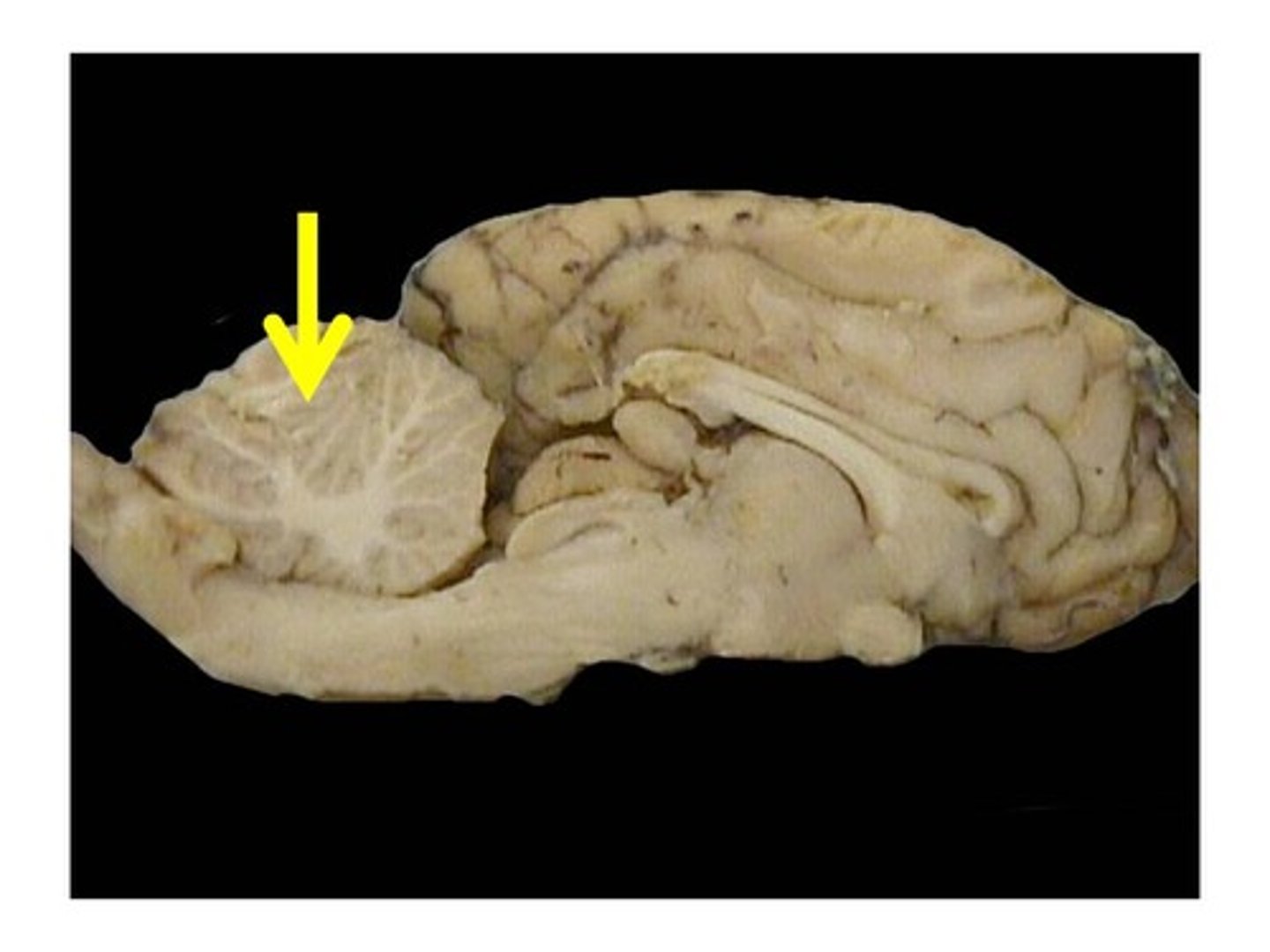 <p>white matter of the cerebellum; controls coordination of the arms, legs and any actions requiring hand-eye coordination</p>