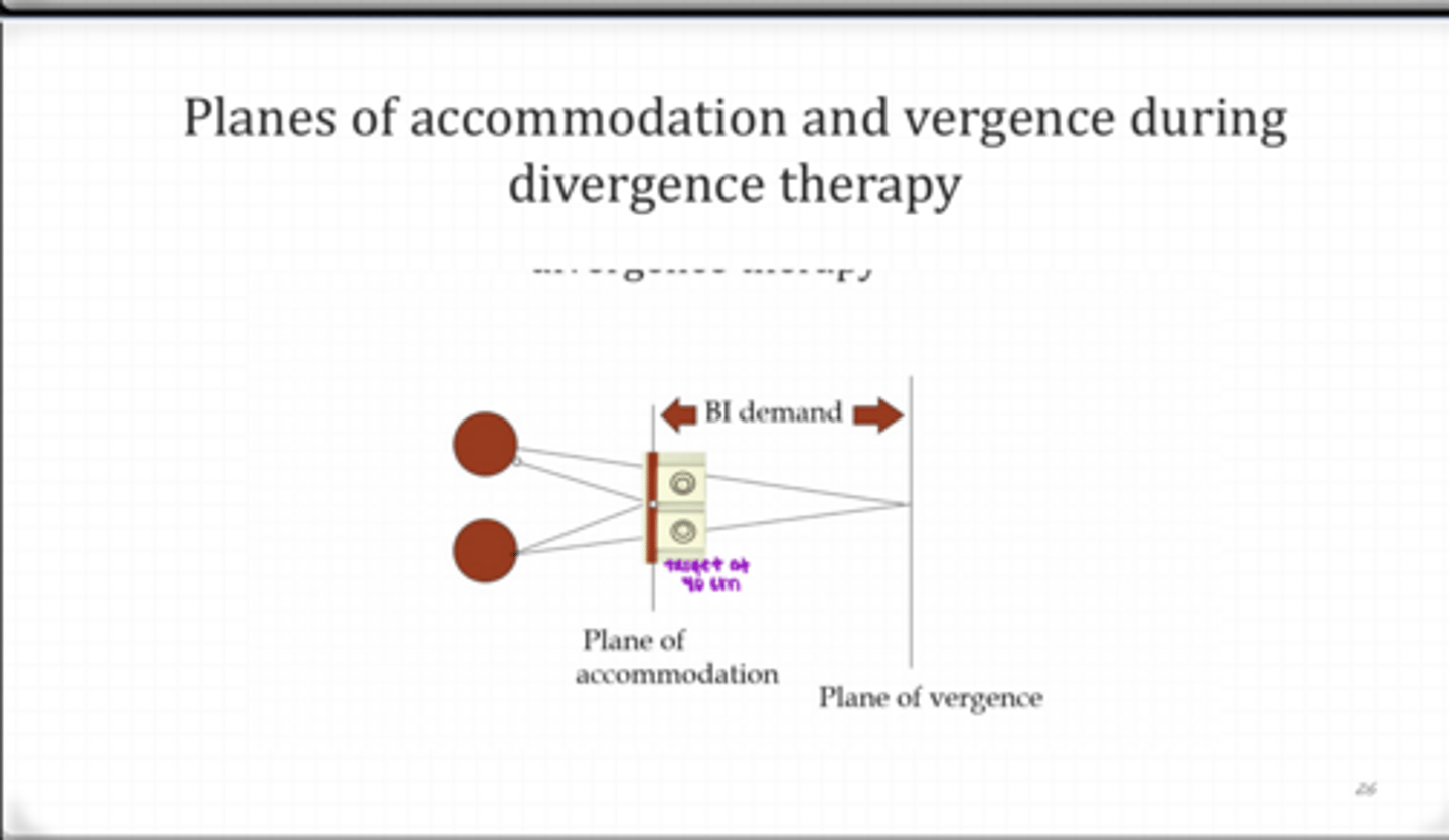 <p>Planes of Accommodation and Vergence During Divergence Therapy (Pic)</p>