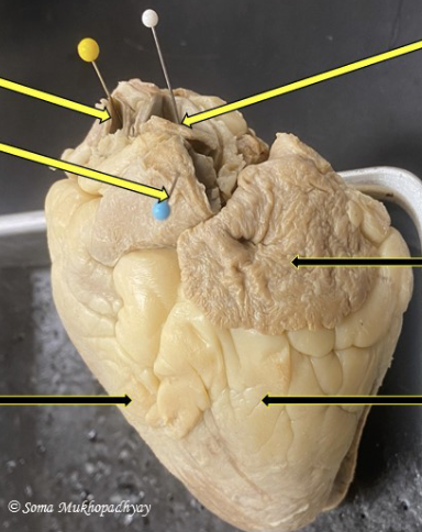 <p>is this the anterior view or posterior view<br>label from top to bottom&nbsp;</p>