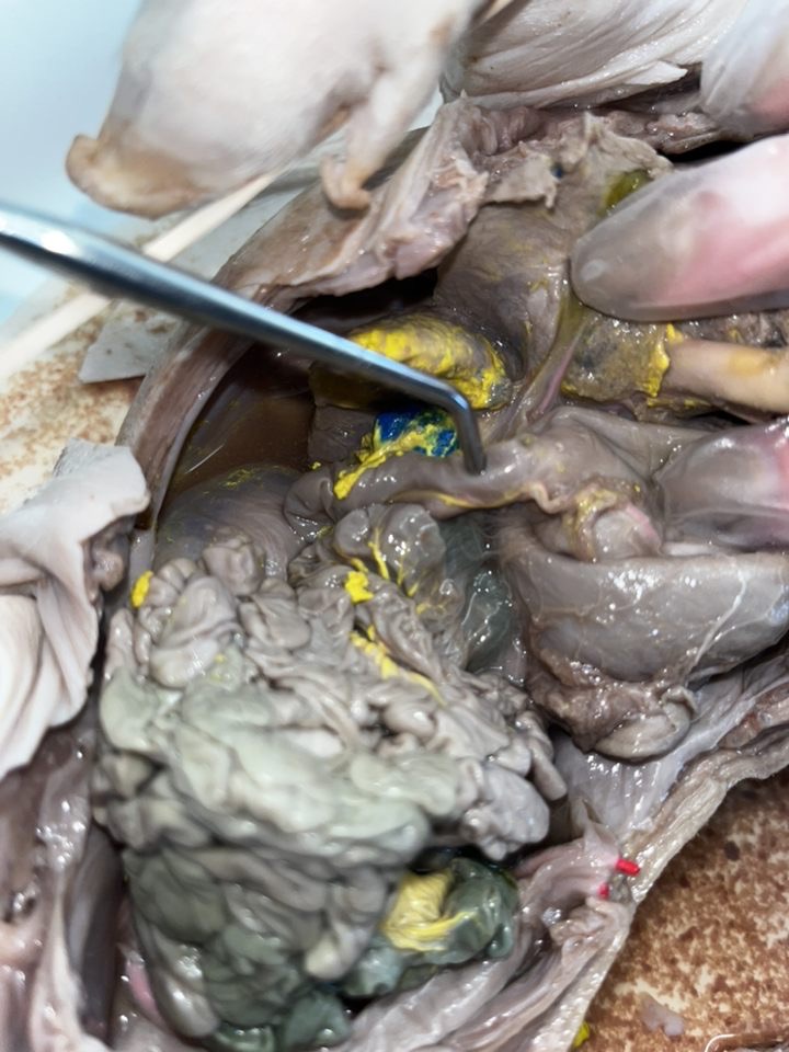 <p>What region of the small intestine is shown?</p>