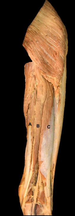 <p>A</p>