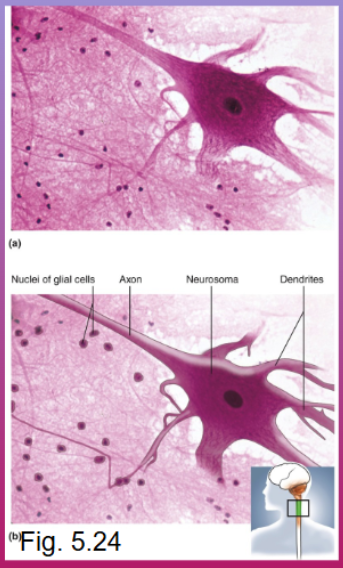 <p>Most sections show a few large neurons, usually with rounded or stellate cell bodies and fibrous processes (axon and dendrites) extending from the cell bodies; neurons are surrounded by a greater number of much smaller glial cells, which lack dendrites and axons</p>