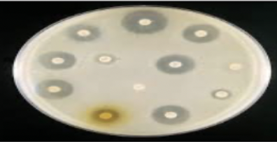 <p>Growth of bacteria taken from a wound or lesion in a lab; colonies are used to make a diagnosis and to determine the correct antibiotic treatment.</p>