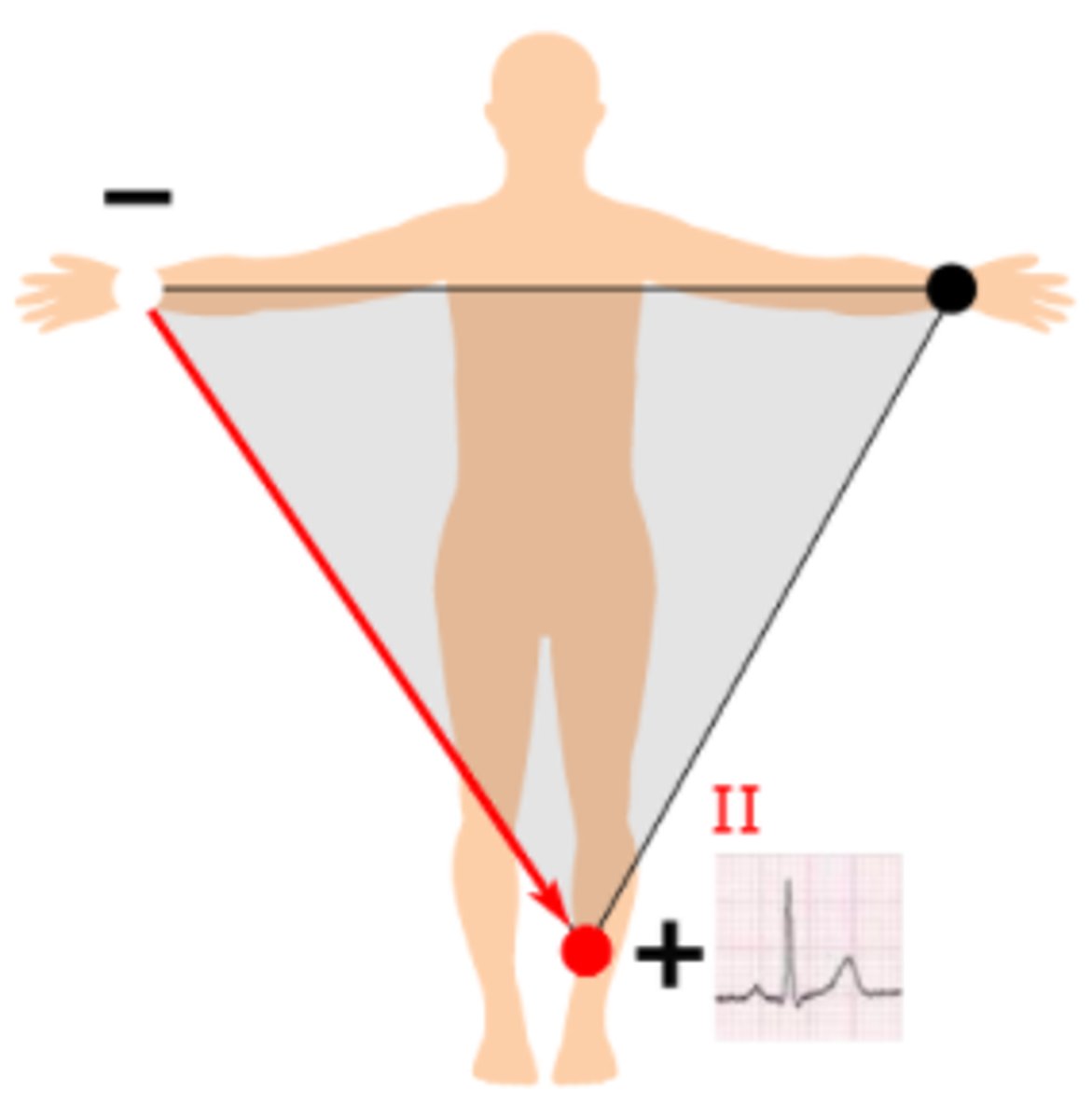 <p>From the right arm to the left leg with the positive electrode being at the left leg, at 60°</p>